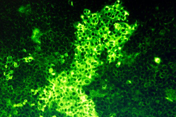 Smitta på samhällskroppen.