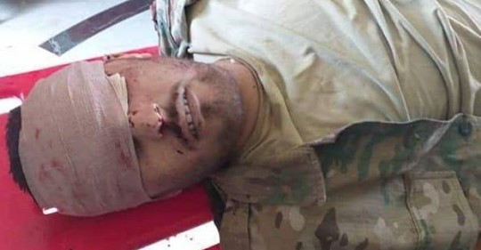 Spelkomponentseliminering