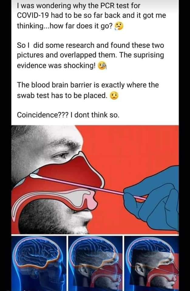 Bekymmersama Komponenter