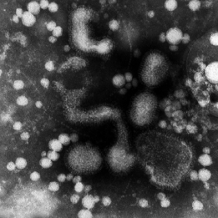 Tegnell & Spanska Sjukan