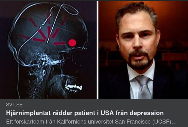 Svår Depressionsstudie I Umeå