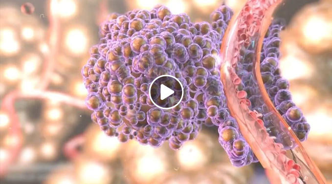 Sibirisk Cancermetastasblockerare