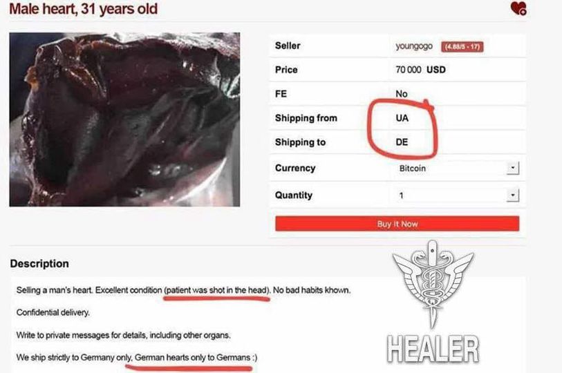 Ukrainsk Organförsäljning